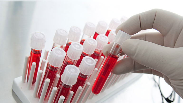 Τεστ αίματος διακρίνει αν η λοίμωξη οφείλεται σε ιό ή βακτήριο